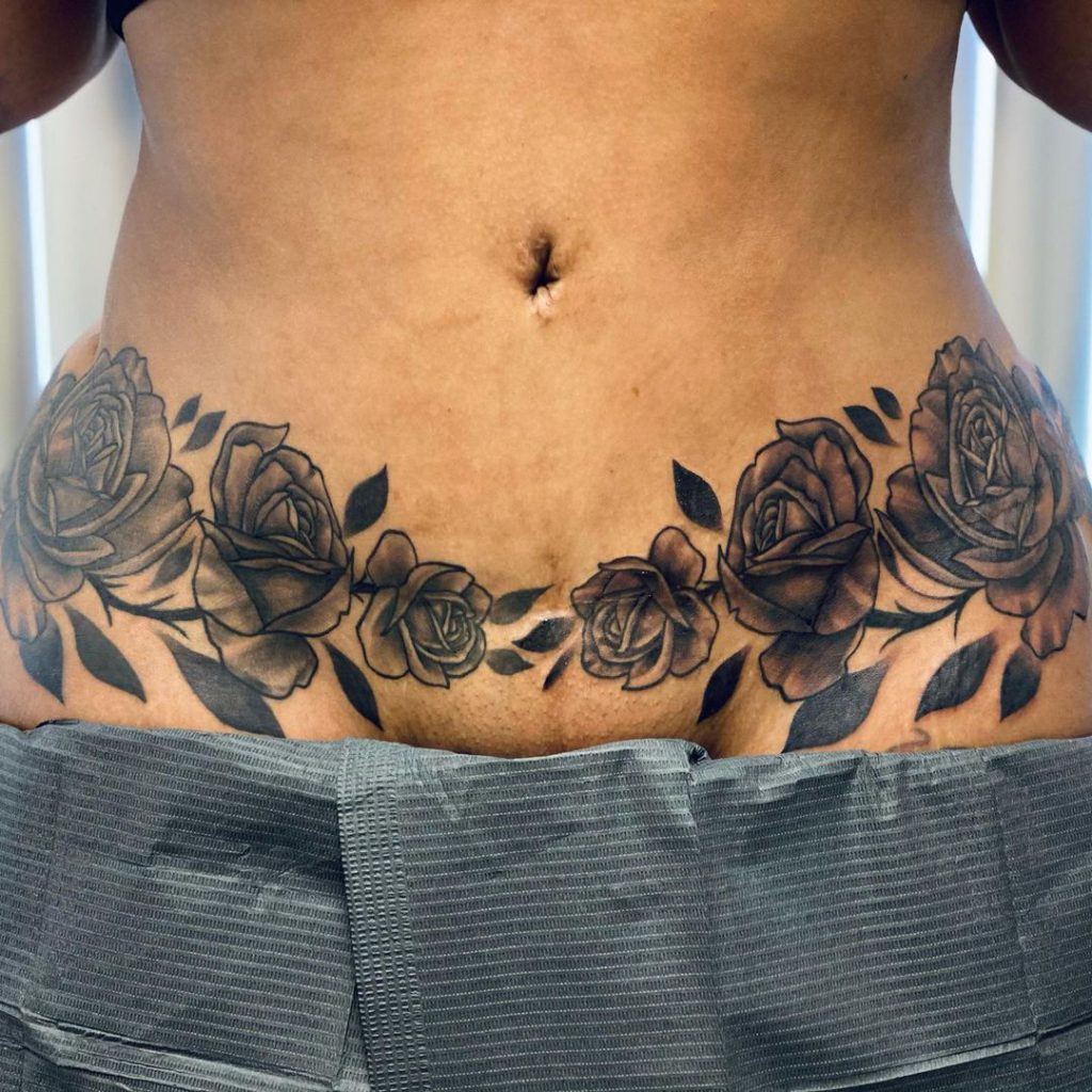 Bold Rose Tummy Tuck Tattoo