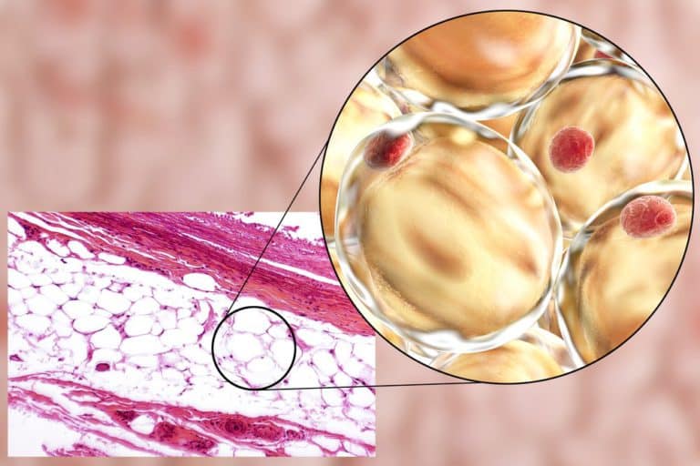 How Long Does It Take Fat Cells To Grow After a BBL