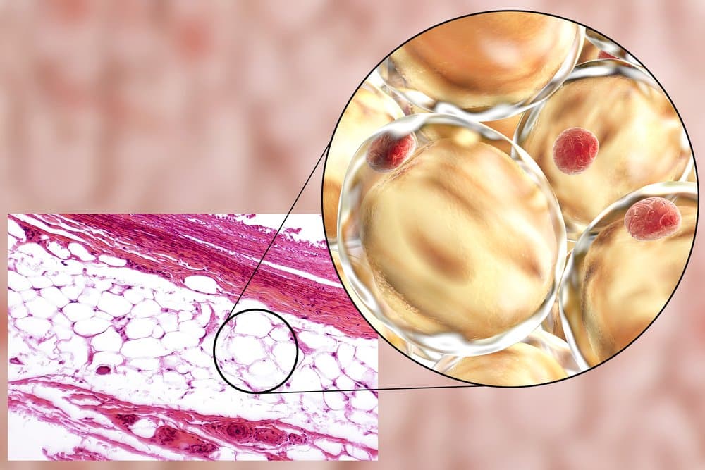 How Long Does It Take Fat Cells To Grow After a BBL