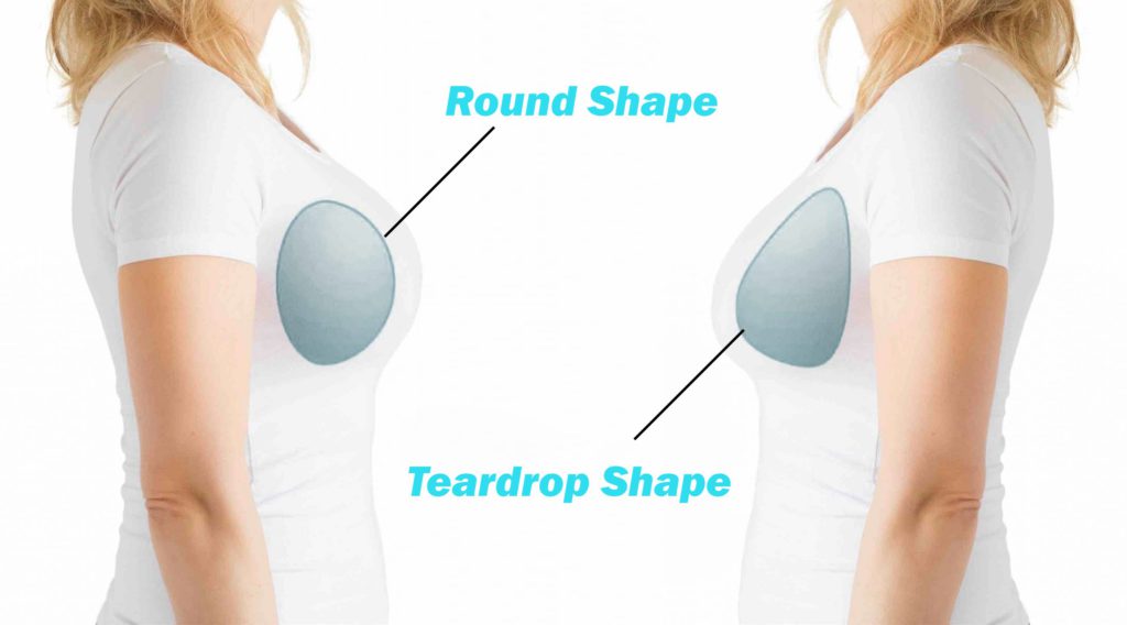 How are teardrop shapes different from round implants