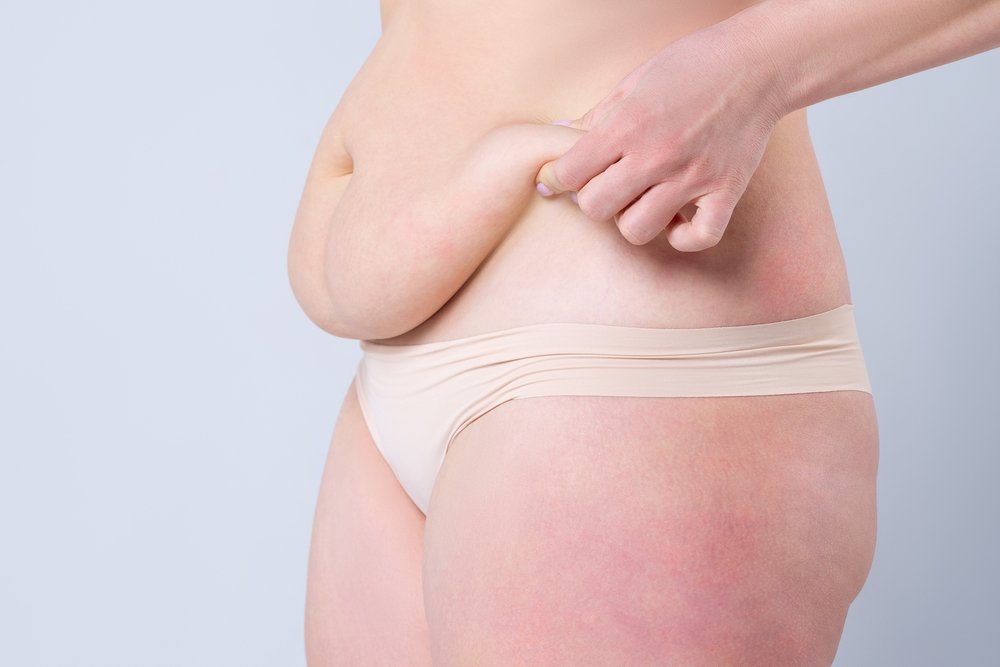 Liposuction vs Tummy Tuck