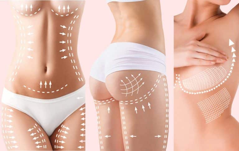 Mommy Makeover Hourglass Surgery