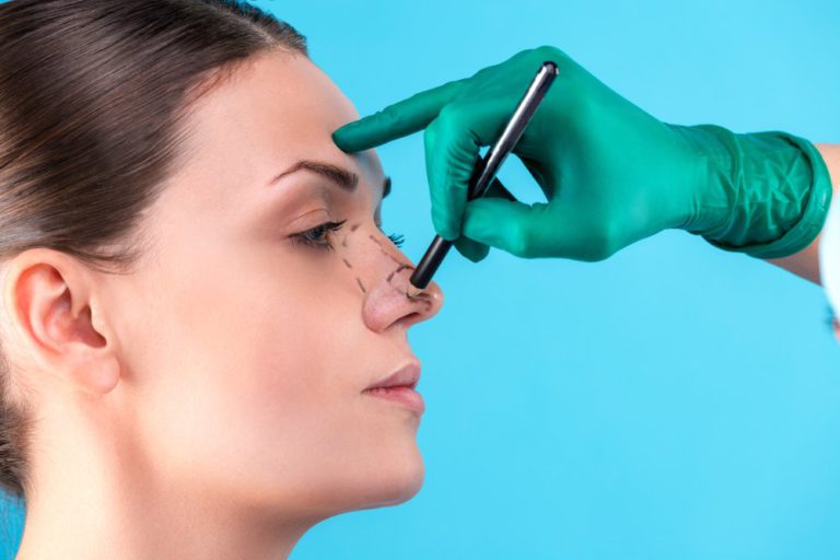 what is a septoplasty with rhinoplasty