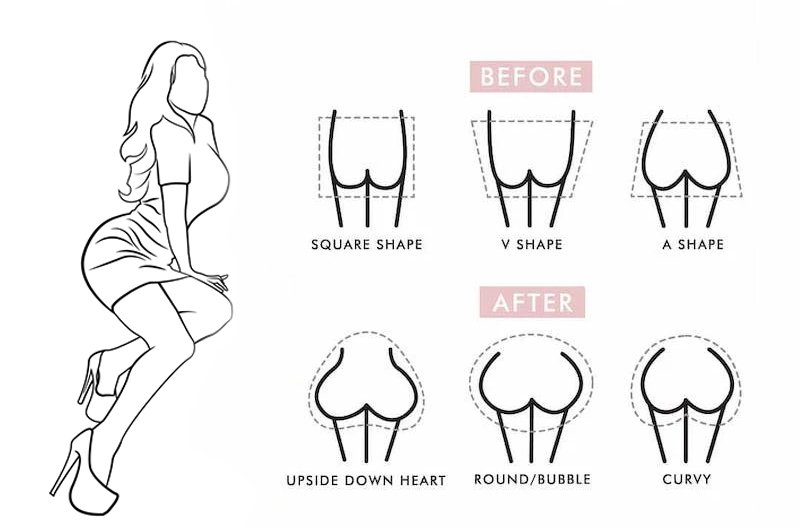 Different types of BBL shapes