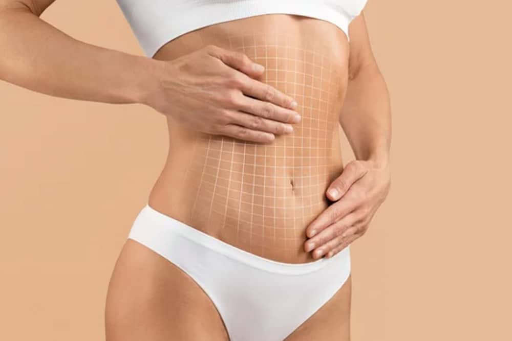 Tumescent Liposuction Vs. Smart Lipo