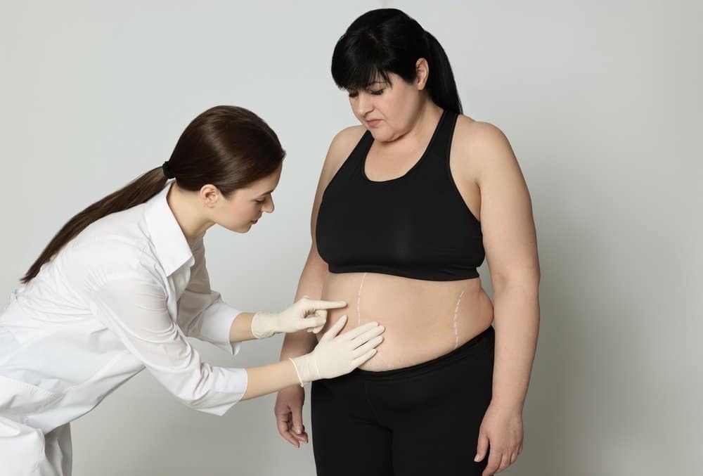 Who is the Perfect Candidate for Bariatric Surgery