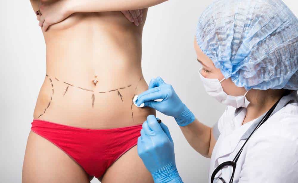 Hourglass Tummy Tuck Miami