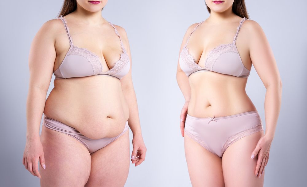 What is lipo 360? It is looking at the body in multiple dimensions