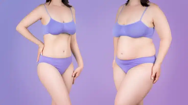 Mommy makeover vs tummy tuck