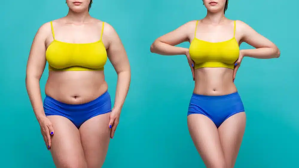 The Benefits of a Tummy Tuck and Mommy Makeover