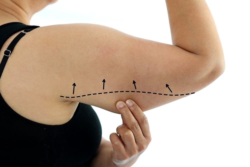 How Long Does Nerve Pain Last After Brachioplasty