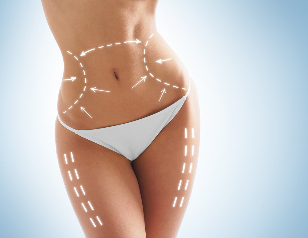 How Many Pounds can Lipo 360 Remove