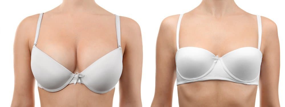 The Procedure of Lipolift Breast Reduction