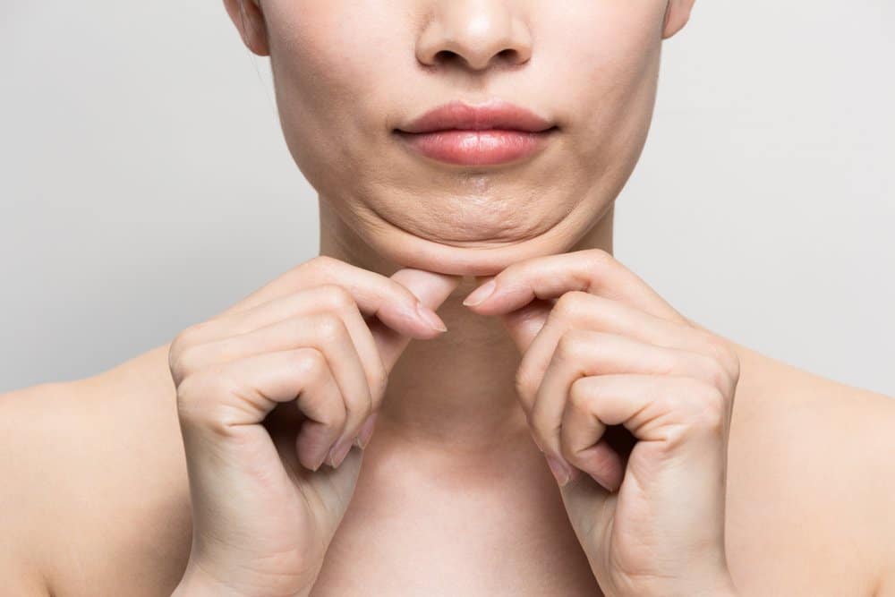 What Is Vaser Chin Liposuction