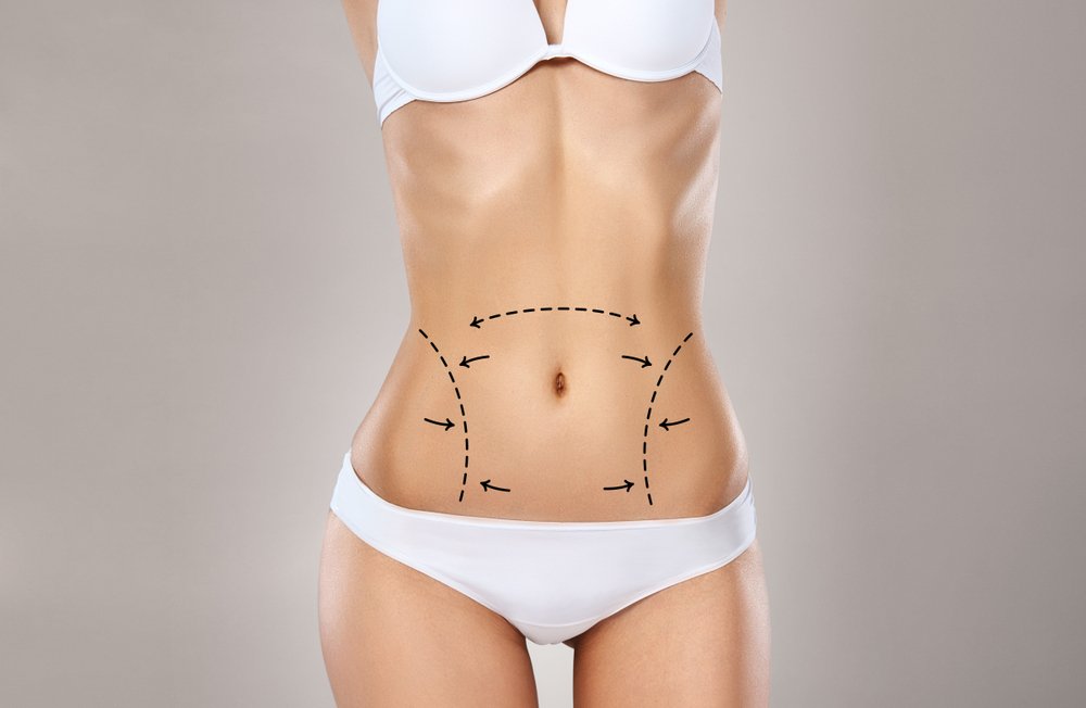 Plus Size Lipo 360: Achieve Your Ideal Body